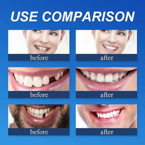 ⏰Ends Today: 70% OFF 🦷 Get Your Smile Back Without Expensive Dental Visits Custom-Fit Comfort Dentures-8RH7
