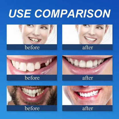 ⏰Ends Today: 70% OFF 🦷 Get Your Smile Back Without Expensive Dental Visits Custom-Fit Comfort Dentures-8RH7