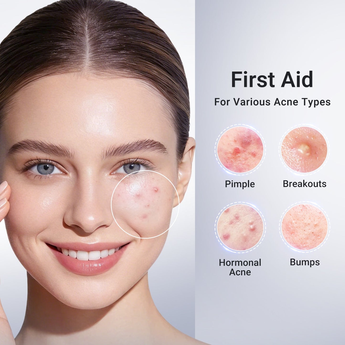 ✨ Shrink Pimples Overnight-Encapsulated Salicylic Acid Drying Lotion-8RH7