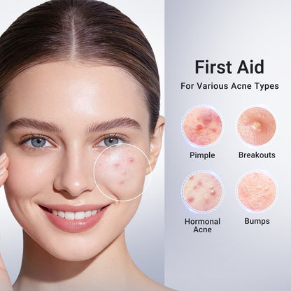 ✨ Shrink Pimples Overnight-Encapsulated Salicylic Acid Drying Lotion-8RH7