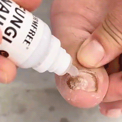 🦶Toenail Fungus Treatment Extra Strength | Nail Repair for Thick Yellow Discolored Nails💅-8HJ9