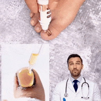 🦶Toenail Fungus Treatment Extra Strength | Nail Repair for Thick Yellow Discolored Nails💅-8HJ9