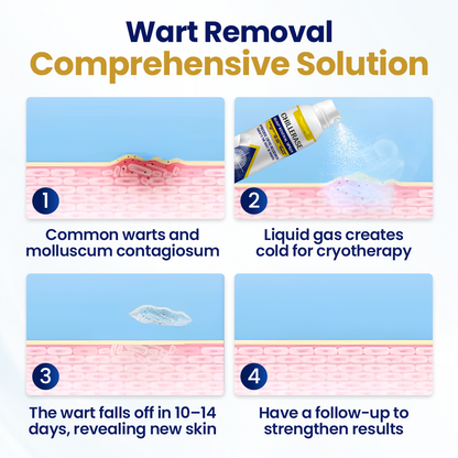 🏆 #1 Dermatologist-Recommended Cryo Renewal Spray🥼| Removes warts and skin tags efficiently while promoting your skin’s natural recovery🧪-8HJ9