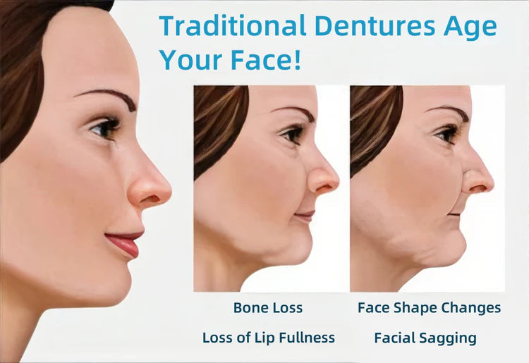 ⏰Ends Today: 70% OFF 🦷 Get Your Smile Back Without Expensive Dental Visits Custom-Fit Comfort Dentures-8RH7