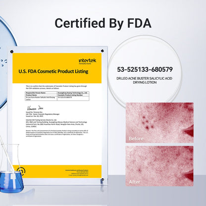 ✨ Shrink Pimples Overnight-Encapsulated Salicylic Acid Drying Lotion-8RH7