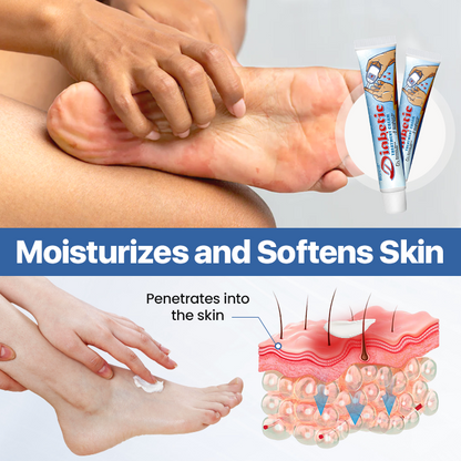 🩺No more pain from diabetic wounds immediately!🧪VitaGluco Diabetes Treatment Cream✨-8HJ9