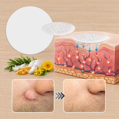 ⏰Ends Today: 60% OFF✨2-in-1 Microneedle & Hydrocolloid Patch | Removes Raised Moles, Acne, Flat Warts & Skin Tags -8RH7