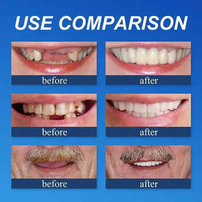 ⏰Ends Today: 70% OFF 🦷 Get Your Smile Back Without Expensive Dental Visits Custom-Fit Comfort Dentures-8RH7
