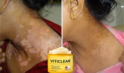 🐝🔥 BEST SELLER 50% OFF ✨ VitiClear Bee Venom Cream Ultra–Improve Skin Pigmentation, Natural Formula, Suitable for All Skin-8YF7