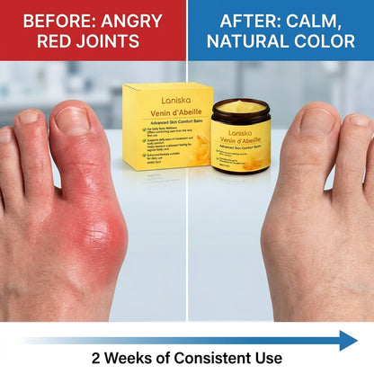 【Hot 🎯 | 30k+ Sold⭐】 New Zealand Bee Venom Bone and Joint Treatment Cream, help repair joint tissue, reduce cysts and swelling-8SA8