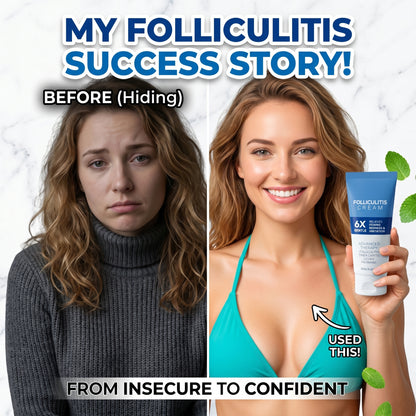 🌟【Top Choice|Over 10k+ Sold🥇】Folliculitis Soothing Cream - Organic Gentle Botanical Formula for Scalp Face & Body Advanced Formula-8SA8