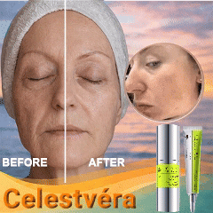【Hot sale 🎯 | 30k+ Sold⭐】Retinol Shot Tightening Serum Get Botox-Level Tightening Without the Needle, Stroke Face, or 800 Maintenance!-8SA8