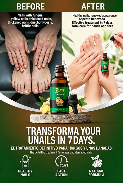 🌏Hot Selling Globally🥇🔥7 DAYS Nail Fungus Treatment, healthy and strong nails-8SA8