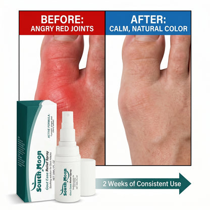 🔥Hot  | 30k+ Sold✅【GoutEase Relief Spray】Targeted relief from gout pain, penetrates deeply to calm inflammation, break down uric acid-8SA8