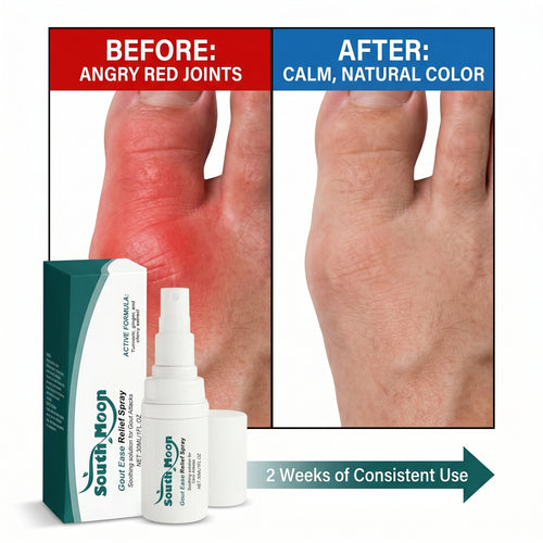 🔥Hot  | 30k+ Sold✅【GoutEase Relief Spray】Targeted relief from gout pain, penetrates deeply to calm inflammation, break down uric acid-8SA8