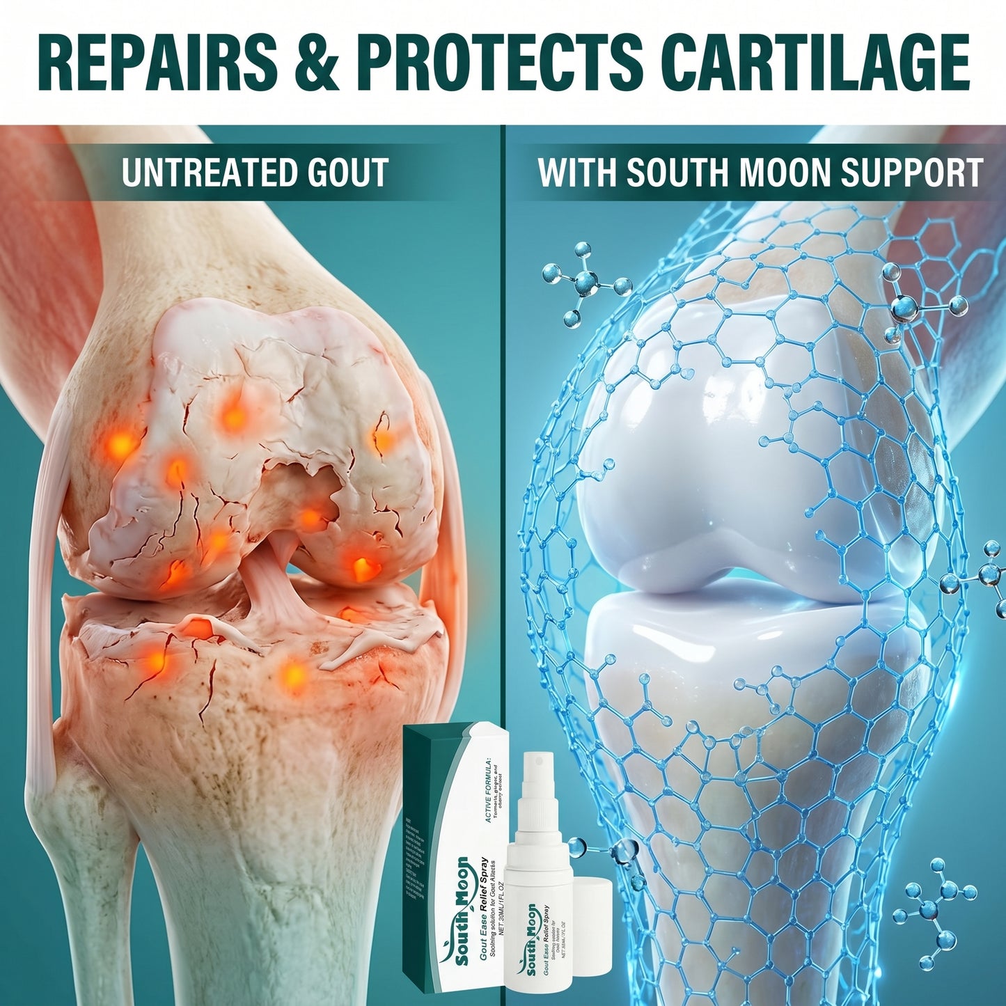 🔥Hot  | 30k+ Sold✅【GoutEase Relief Spray】Targeted relief from gout pain, penetrates deeply to calm inflammation, break down uric acid-8SA8