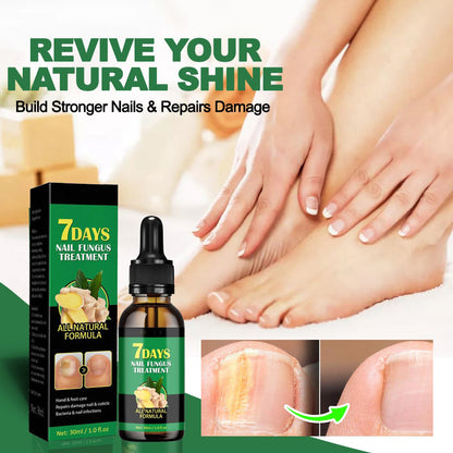 🌏Hot Selling Globally🥇🔥7 DAYS Nail Fungus Treatment, healthy and strong nails-8SA8