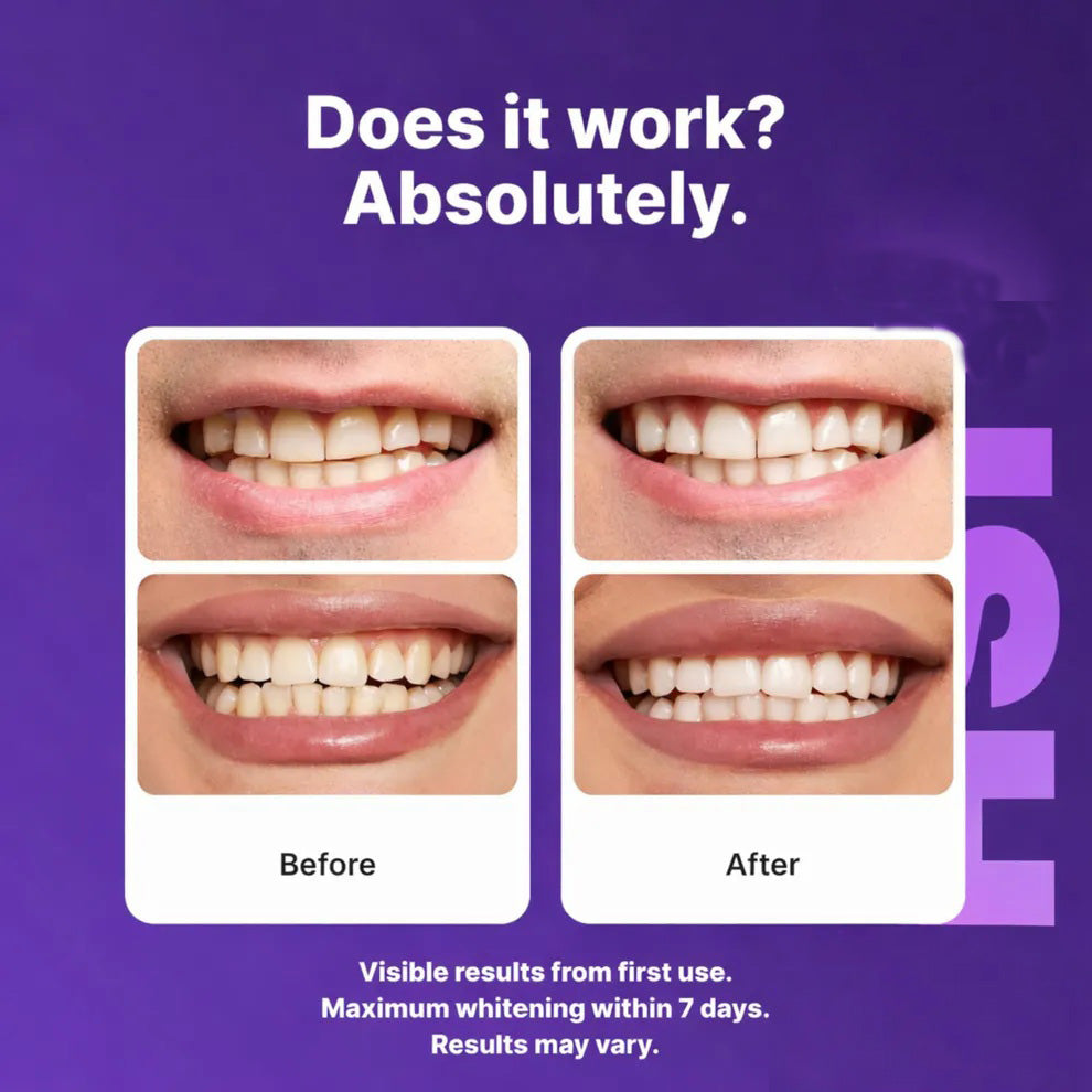 Purple Teeth Whitening Strips，Safe for Enamel - Non Sensitive Teeth Whitening - Peroxide-Free-8SA8
