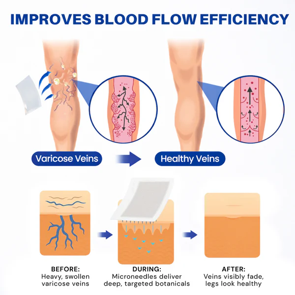 👨‍⚕️🔥 Vein Target Microneedle Care Patch⚡Instant Relief, Long-Term Results-8JX3