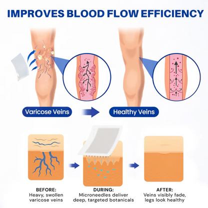 👨‍⚕️🔥 Vein Target Microneedle Care Patch⚡Instant Relief, Long-Term Results-8JX3