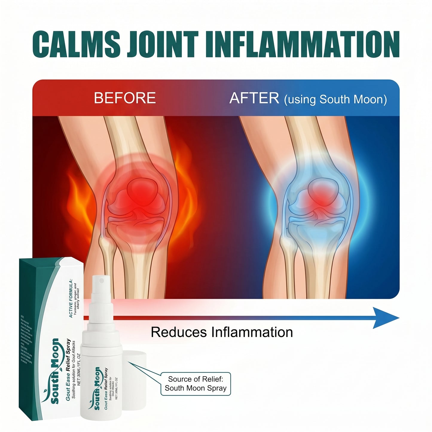 🔥Hot  | 30k+ Sold✅【GoutEase Relief Spray】Targeted relief from gout pain, penetrates deeply to calm inflammation, break down uric acid-8SA8