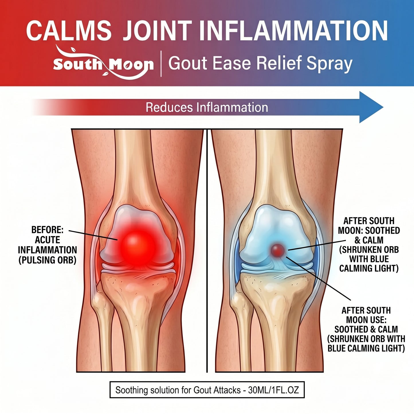 🔥Hot  | 30k+ Sold✅【GoutEase Relief Spray】Targeted relief from gout pain, penetrates deeply to calm inflammation, break down uric acid-8SA8