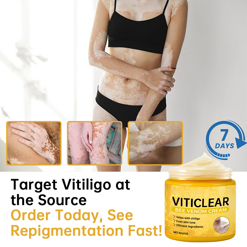 🐝🔥 BEST SELLER 50% OFF ✨ VitiClear Bee Venom Cream Ultra–Improve Skin Pigmentation, Natural Formula, Suitable for All Skin-8YF7