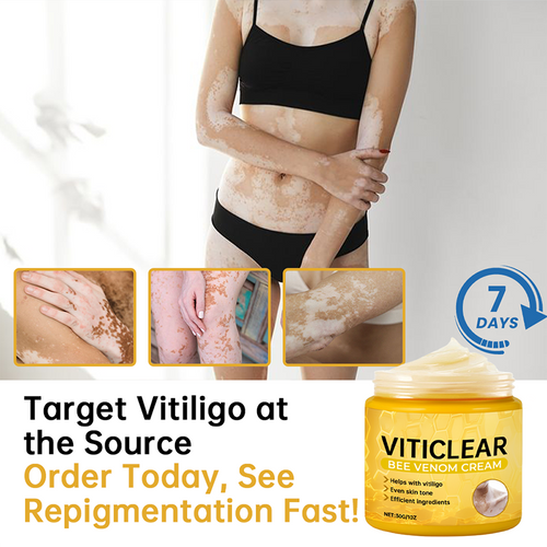 🐝🔥 BEST SELLER 50% OFF ✨ VitiClear Bee Venom Cream Ultra–Improve Skin Pigmentation, Natural Formula, Suitable for All Skin-8YF7