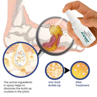 🔥Hot  | 30k+ Sold✅【GoutEase Relief Spray】Targeted relief from gout pain, penetrates deeply to calm inflammation, break down uric acid-8SA8