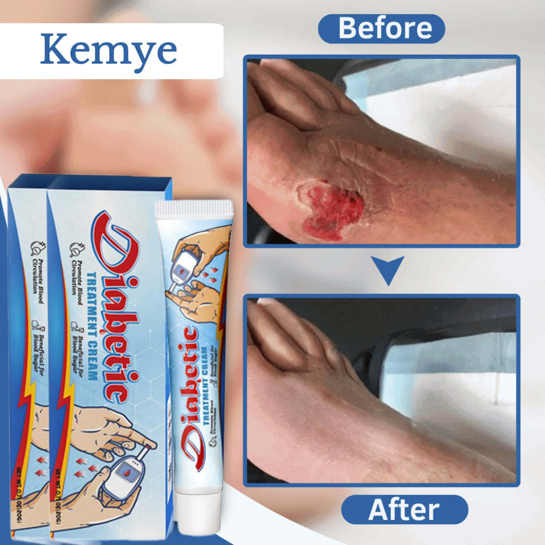 🩺No more pain from diabetic wounds immediately!🧪VitaGluco Diabetes Treatment Cream✨-8HJ9