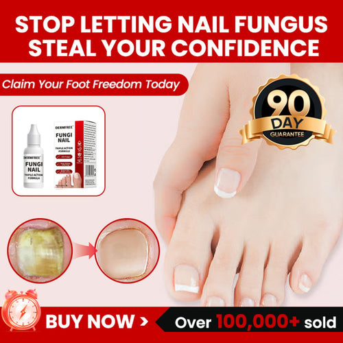 🦶Toenail Fungus Treatment Extra Strength | Nail Repair for Thick Yellow Discolored Nails💅-8HJ9