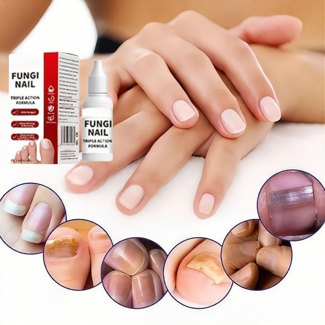 🦶Toenail Fungus Treatment Extra Strength | Nail Repair for Thick Yellow Discolored Nails💅-8HJ9