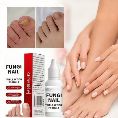 🦶Toenail Fungus Treatment Extra Strength | Nail Repair for Thick Yellow Discolored Nails💅-8HJ9