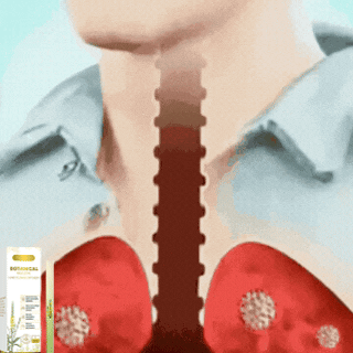 💥2026 New Upgrade | Cleanse Your Airways by 98% in Just 7 Days!🌿Herbal Lung-Clearing Inhaler✨-8HJ9