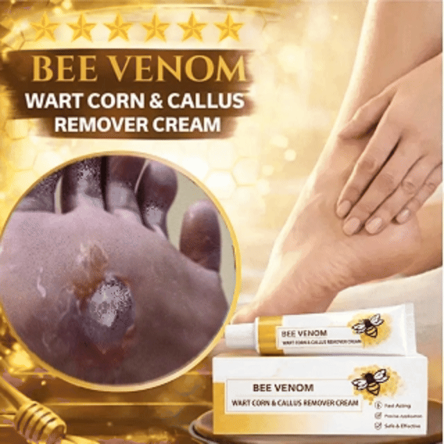 🔥LIMITED TIME DISCOUNT🔥 Sandal Confidence Again—Without Shame, Without Pain, Without Recurrence🤩|Bee Venom Wart Corn & Callus Remover Cream🐝-8HJ9