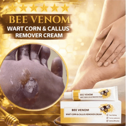 🔥LIMITED TIME DISCOUNT🔥 Sandal Confidence Again—Without Shame, Without Pain, Without Recurrence🤩|Bee Venom Wart Corn & Callus Remover Cream🐝-8HJ9