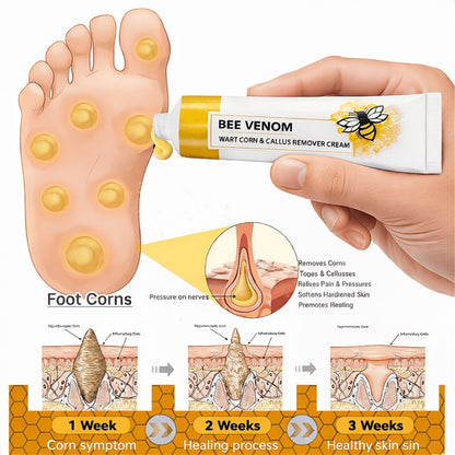 🔥LIMITED TIME DISCOUNT🔥 Sandal Confidence Again—Without Shame, Without Pain, Without Recurrence🤩|Bee Venom Wart Corn & Callus Remover Cream🐝-8HJ9