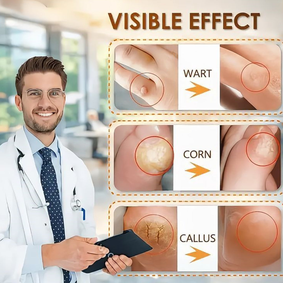 🔥LIMITED TIME DISCOUNT🔥 Sandal Confidence Again—Without Shame, Without Pain, Without Recurrence🤩|Bee Venom Wart Corn & Callus Remover Cream🐝-8HJ9