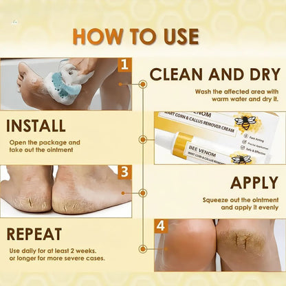 🔥LIMITED TIME DISCOUNT🔥 Sandal Confidence Again—Without Shame, Without Pain, Without Recurrence🤩|Bee Venom Wart Corn & Callus Remover Cream🐝-8HJ9