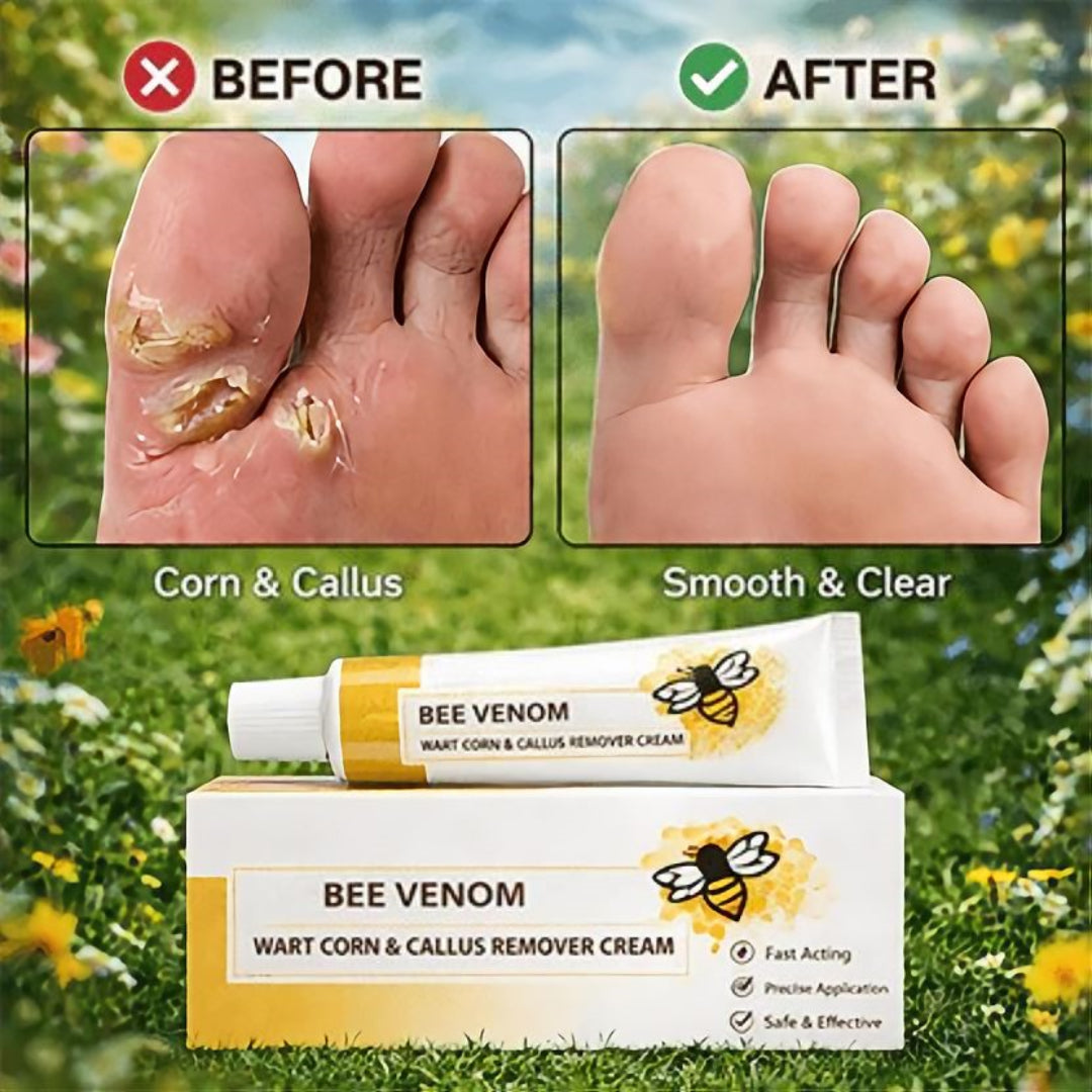 🔥LIMITED TIME DISCOUNT🔥 Sandal Confidence Again—Without Shame, Without Pain, Without Recurrence🤩|Bee Venom Wart Corn & Callus Remover Cream🐝-8HJ9