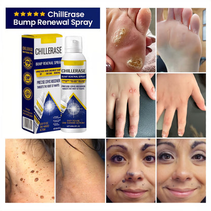🏆 #1 Dermatologist-Recommended Cryo Renewal Spray🥼| Removes warts and skin tags efficiently while promoting your skin’s natural recovery🧪-8HJ9