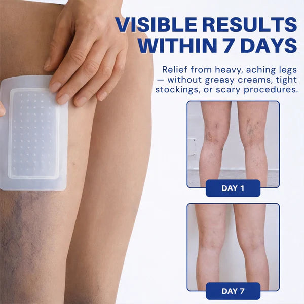 👨‍⚕️🔥 Vein Target Microneedle Care Patch⚡Instant Relief, Long-Term Results-8JX3