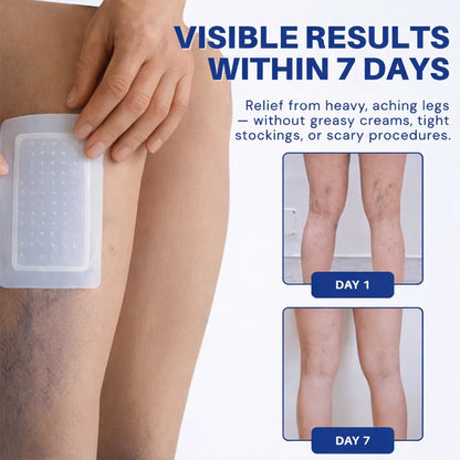 👨‍⚕️🔥 Vein Target Microneedle Care Patch⚡Instant Relief, Long-Term Results-8JX3