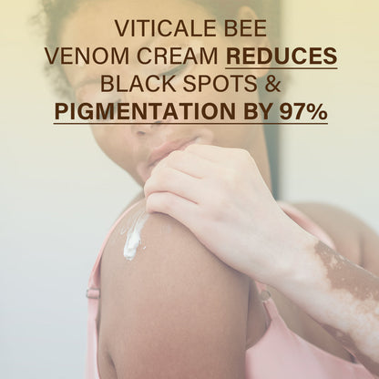 🐝🔥 BEST SELLER 50% OFF ✨ VitiClear Bee Venom Cream Ultra–Improve Skin Pigmentation, Natural Formula, Suitable for All Skin-8YF7