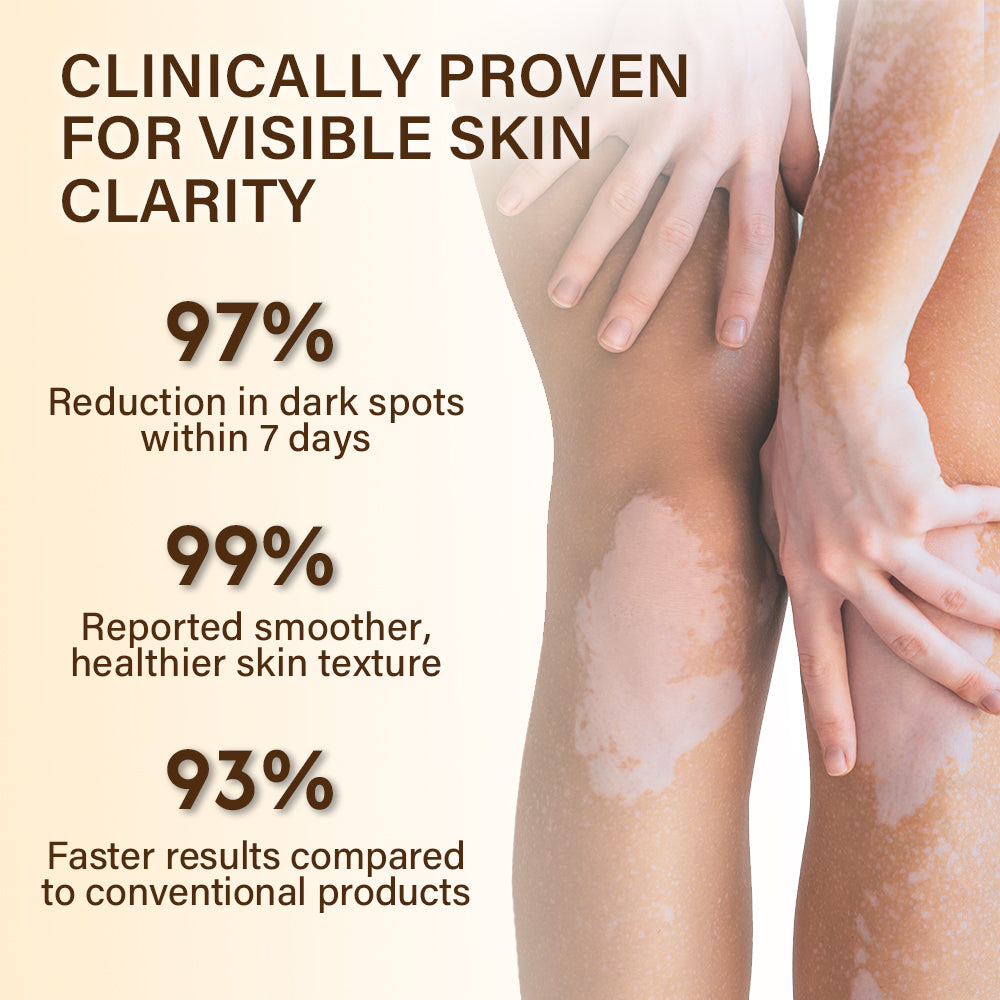 🐝🔥 BEST SELLER 50% OFF ✨ VitiClear Bee Venom Cream Ultra–Improve Skin Pigmentation, Natural Formula, Suitable for All Skin-8YF7