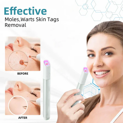 ✨ LIMITED TIME 50% OFF 💖All-in-One CO₂ Laser Eraser Pen | Removes Moles, Warts, Skin Flaws & Pigmentation-8YF7