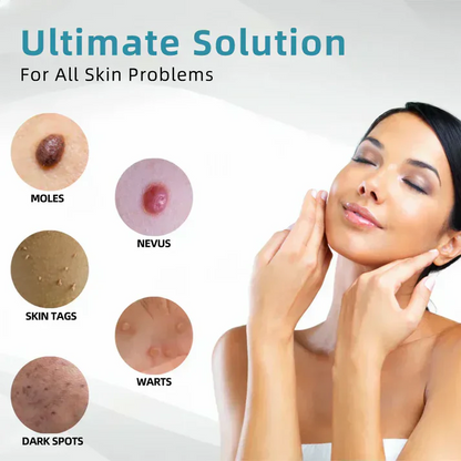 ✨ LIMITED TIME 50% OFF 💖All-in-One CO₂ Laser Eraser Pen | Removes Moles, Warts, Skin Flaws & Pigmentation-8YF7