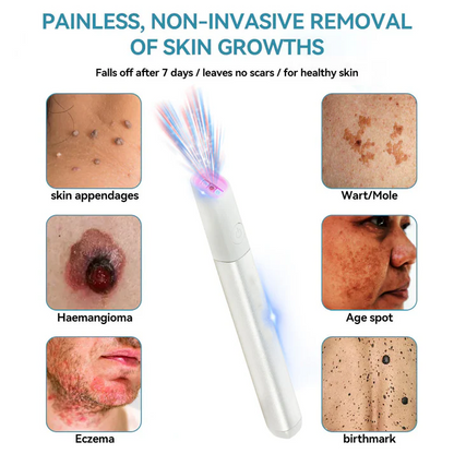 ✨ LIMITED TIME 50% OFF 💖All-in-One CO₂ Laser Eraser Pen | Removes Moles, Warts, Skin Flaws & Pigmentation-8YF7