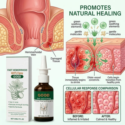 🔥50% OFF LIMITED TIME🩸Instant Hemorrhoid Relief Spray | Eliminate Itching, Burning & Painful Irritation Fast-8YF7