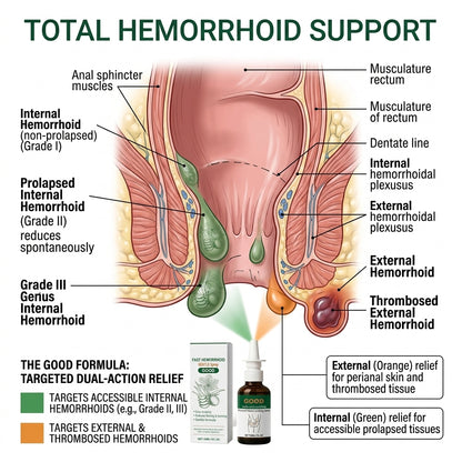 🔥50% OFF LIMITED TIME🩸Instant Hemorrhoid Relief Spray | Eliminate Itching, Burning & Painful Irritation Fast-8YF7